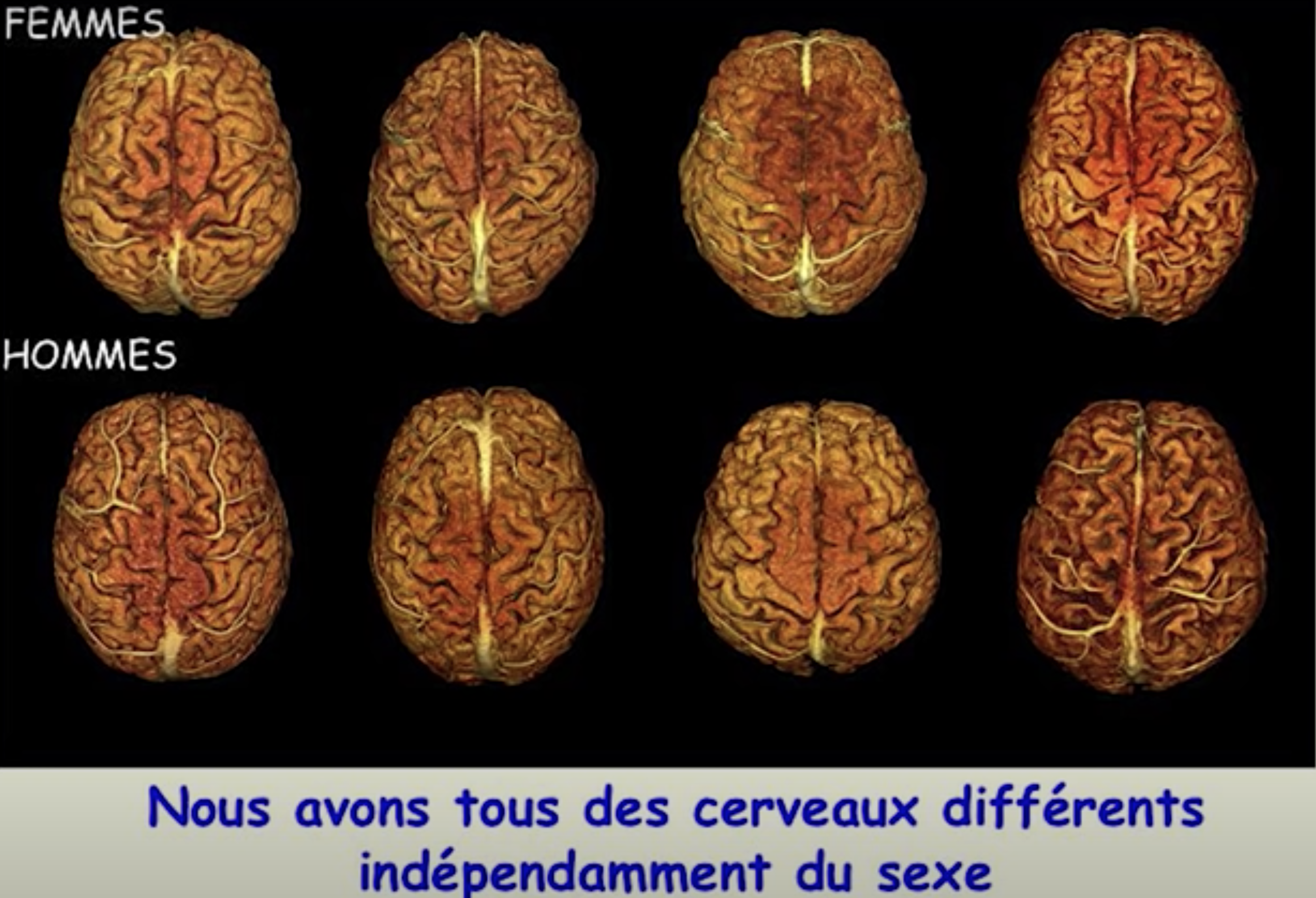 différents cerveaux